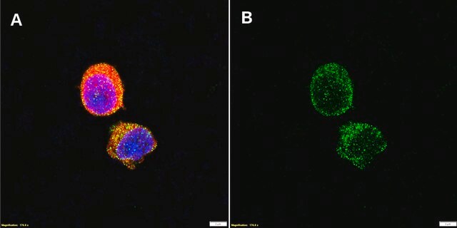 Anti-CCR6/CD196 Antibody, clone 1K9 ZooMAb&#174; Rabbit Monoclonal recombinant, expressed in HEK 293 cells