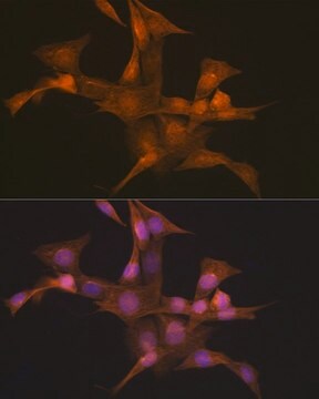 Anti-Nesprin 1 antibody produced in rabbit