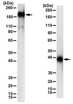 Anti-SARS-CoV-2 spike protein S1 domain