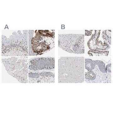 Anti-GRHL1 antibody produced in rabbit Ab1, Prestige Antibodies&#174; Powered by Atlas Antibodies, affinity isolated antibody, buffered aqueous glycerol solution