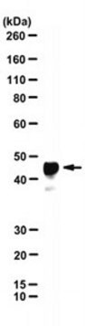 Anti-Rabies Virus Phosphoprotein Antibody, clone M957