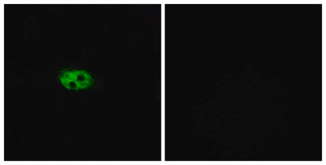 Anti-NK3R, C-Terminal antibody produced in rabbit affinity isolated antibody