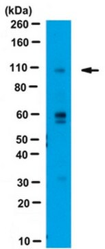 Anti-WWP2 Antibody from rabbit, purified by affinity chromatography