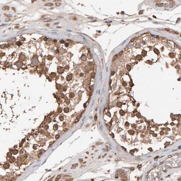 Anti-RNF19A antibody produced in rabbit Prestige Antibodies&#174; Powered by Atlas Antibodies, affinity isolated antibody, buffered aqueous glycerol solution