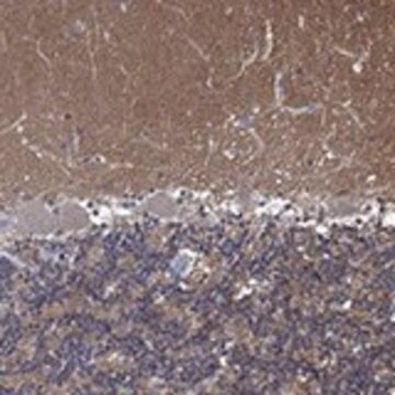 Anti-ZNF671 antibody produced in rabbit Prestige Antibodies&#174; Powered by Atlas Antibodies, affinity isolated antibody, buffered aqueous glycerol solution