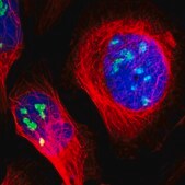 Anti-ZSCAN1 antibody produced in rabbit Prestige Antibodies&#174; Powered by Atlas Antibodies, affinity isolated antibody, buffered aqueous glycerol solution
