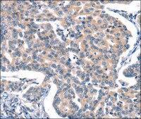 Anti-CACNA1A antibody produced in rabbit affinity isolated antibody