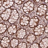 Anti-STAT3 antibody produced in rabbit Prestige Antibodies&#174; Powered by Atlas Antibodies, affinity isolated antibody, buffered aqueous glycerol solution