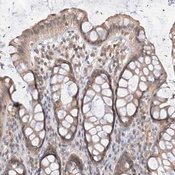 Anti-PPA2 antibody produced in rabbit Prestige Antibodies&#174; Powered by Atlas Antibodies, affinity isolated antibody, buffered aqueous glycerol solution