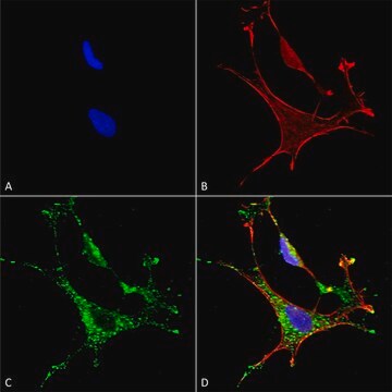 Monoclonal Anti-Copper Transporting Atpase 1 - Apc antibody produced in mouse clone S60-4, purified immunoglobulin