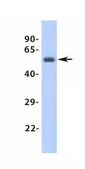 Anti-ADRB1 antibody produced in rabbit affinity isolated antibody