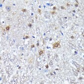 Anti- LC3B antibody produced in rabbit