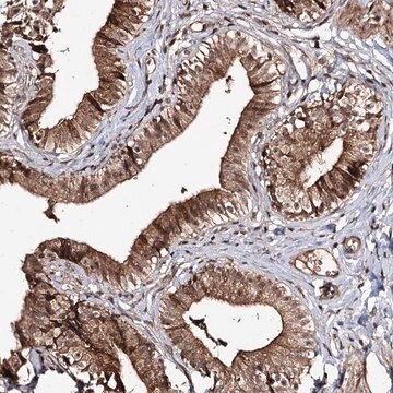 Anti-FAM53B antibody produced in rabbit Prestige Antibodies&#174; Powered by Atlas Antibodies, affinity isolated antibody, buffered aqueous glycerol solution