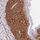 Anti-DPP3 antibody produced in rabbit Prestige Antibodies&#174; Powered by Atlas Antibodies, affinity isolated antibody, buffered aqueous glycerol solution