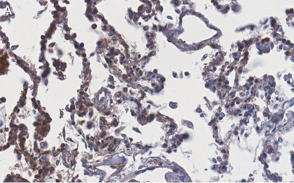 Anti-ACE2-extracellular Antibody, clone 1F21 ZooMAb&#174; Rabbit Monoclonal recombinant, expressed in HEK 293 cells