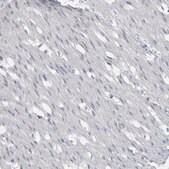 Anti-ACSF2 antibody produced in rabbit Prestige Antibodies&#174; Powered by Atlas Antibodies, affinity isolated antibody, buffered aqueous glycerol solution