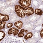 Anti-LYZ antibody produced in rabbit Prestige Antibodies&#174; Powered by Atlas Antibodies, affinity isolated antibody, buffered aqueous glycerol solution