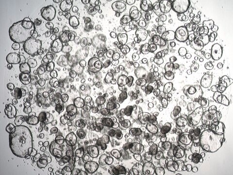 3dGRO Descending Colon Intestinal Organoids, Age 59 (Prep ht-215-CD)