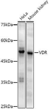 Anti-VDR Antibody, clone 2R1F6, Rabbit Monoclonal