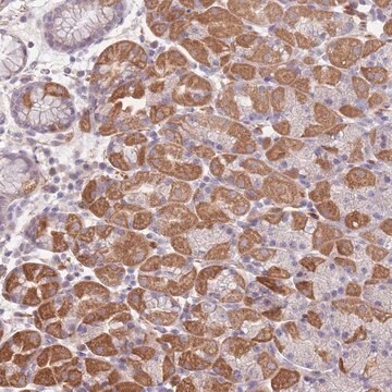 Anti-FAM58A antibody produced in rabbit Prestige Antibodies&#174; Powered by Atlas Antibodies, affinity isolated antibody, buffered aqueous glycerol solution