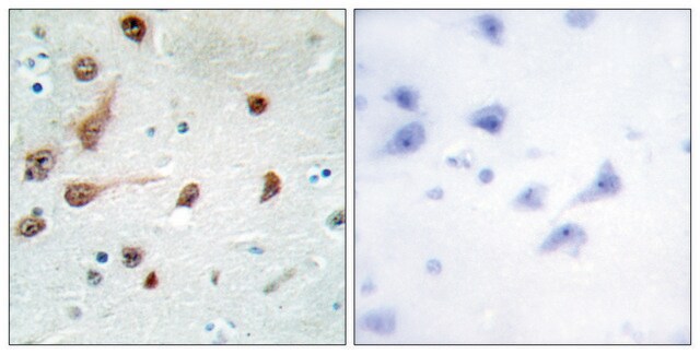 Anti-ADAR1 antibody produced in rabbit affinity isolated antibody