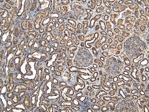 Anti-EWS/EWSR1 antibody produced in goat affinity isolated antibody, buffered aqueous solution
