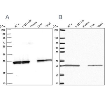 Anti-TPI1 antibody produced in rabbit Prestige Antibodies&#174; Powered by Atlas Antibodies, affinity isolated antibody