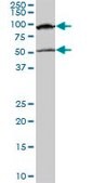 Monoclonal Anti-MECP2 antibody produced in mouse clone 4B6, purified immunoglobulin, buffered aqueous solution