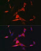 Anti-RAR&#946; Antibody, clone 6D5V4, Rabbit Monoclonal