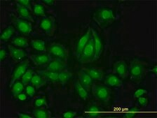 Monoclonal Anti-TYK2 antibody produced in mouse clone 6G12, purified immunoglobulin, buffered aqueous solution