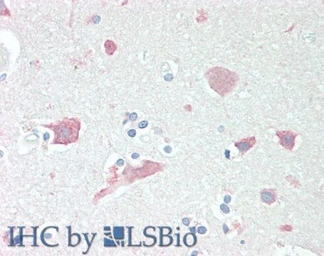 Anti-Neuroserpin antibody produced in goat affinity isolated antibody, buffered aqueous solution