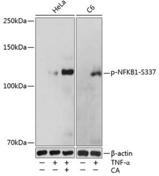 Anti-Phospho-NFKB1-S337 antibody produced in rabbit