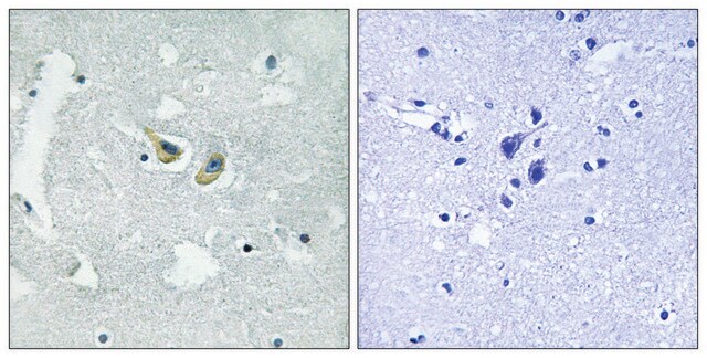 Anti-phospho-p47 phox (pSer345) antibody produced in rabbit affinity isolated antibody