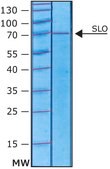 Streptolysin O from Streptococcus pyogenes &#947;-irradiated