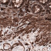 Monoclonal Anti-ACTB antibody produced in mouse Prestige Antibodies&#174; Powered by Atlas Antibodies, clone CL3868, purified immunoglobulin, buffered aqueous glycerol solution