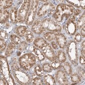 Anti-FH antibody produced in rabbit Prestige Antibodies&#174; Powered by Atlas Antibodies, affinity isolated antibody, buffered aqueous glycerol solution, ab2
