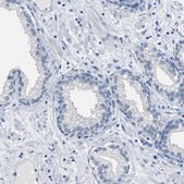 Anti-ACKR2 antibody produced in rabbit Prestige Antibodies&#174; Powered by Atlas Antibodies, affinity isolated antibody, buffered aqueous glycerol solution