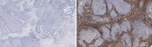 Anti-TAGLN Antibody, clone 1D10 , ZooMAb&#174; Rabbit Monoclonal recombinant, expressed in HEK 293 cells