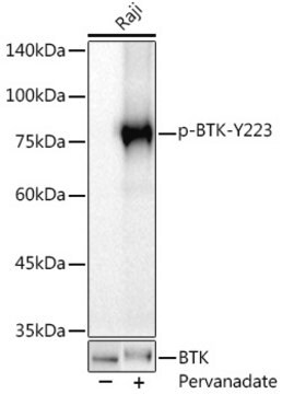 Anti-Phospho-BTK(pTyr223) Antibody, clone 10F4W10, Rabbit Monoclonal