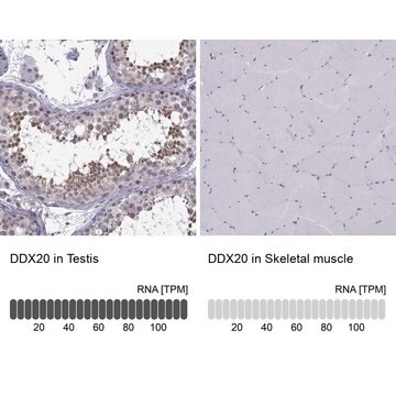 Anti-DDX20 antibody produced in rabbit Prestige Antibodies&#174; Powered by Atlas Antibodies, affinity isolated antibody, buffered aqueous glycerol solution