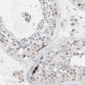 Anti-HJURP antibody produced in rabbit Prestige Antibodies&#174; Powered by Atlas Antibodies, affinity isolated antibody, buffered aqueous glycerol solution