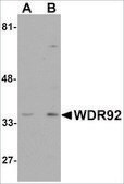 Anti-WDR92 antibody produced in rabbit affinity isolated antibody, buffered aqueous solution