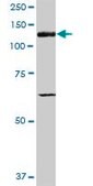 Anti-ITGAV antibody produced in mouse purified immunoglobulin, buffered aqueous solution