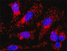 Monoclonal Anti-CTNNB1 antibody produced in mouse clone 1C9, purified immunoglobulin, buffered aqueous solution