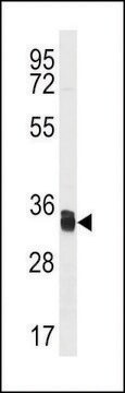 ANTI-TMX1(C-TERMINAL) antibody produced in rabbit affinity isolated antibody, buffered aqueous solution