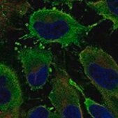 Anti-PDE3A antibody produced in rabbit Prestige Antibodies&#174; Powered by Atlas Antibodies, affinity isolated antibody, buffered aqueous glycerol solution