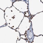 Anti-PTPN1 antibody produced in rabbit Prestige Antibodies&#174; Powered by Atlas Antibodies, affinity isolated antibody, buffered aqueous glycerol solution