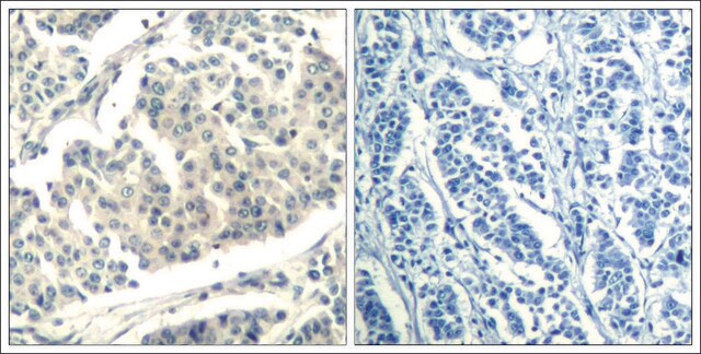 Anti-phospho-ABL1/ABL2 (pTyr393/429) antibody produced in rabbit affinity isolated antibody