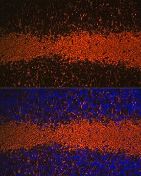 Anti-Myelin Basic Protein antibody produced in rabbit