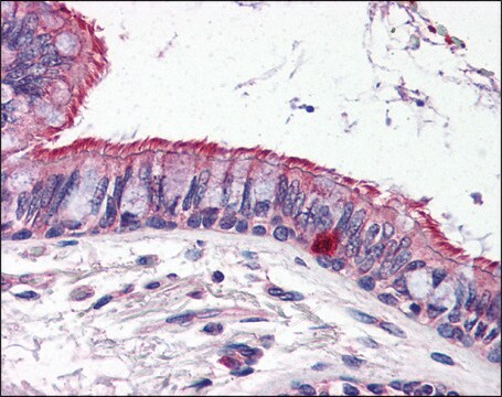 Anti-ELOVL6 antibody produced in rabbit affinity isolated antibody